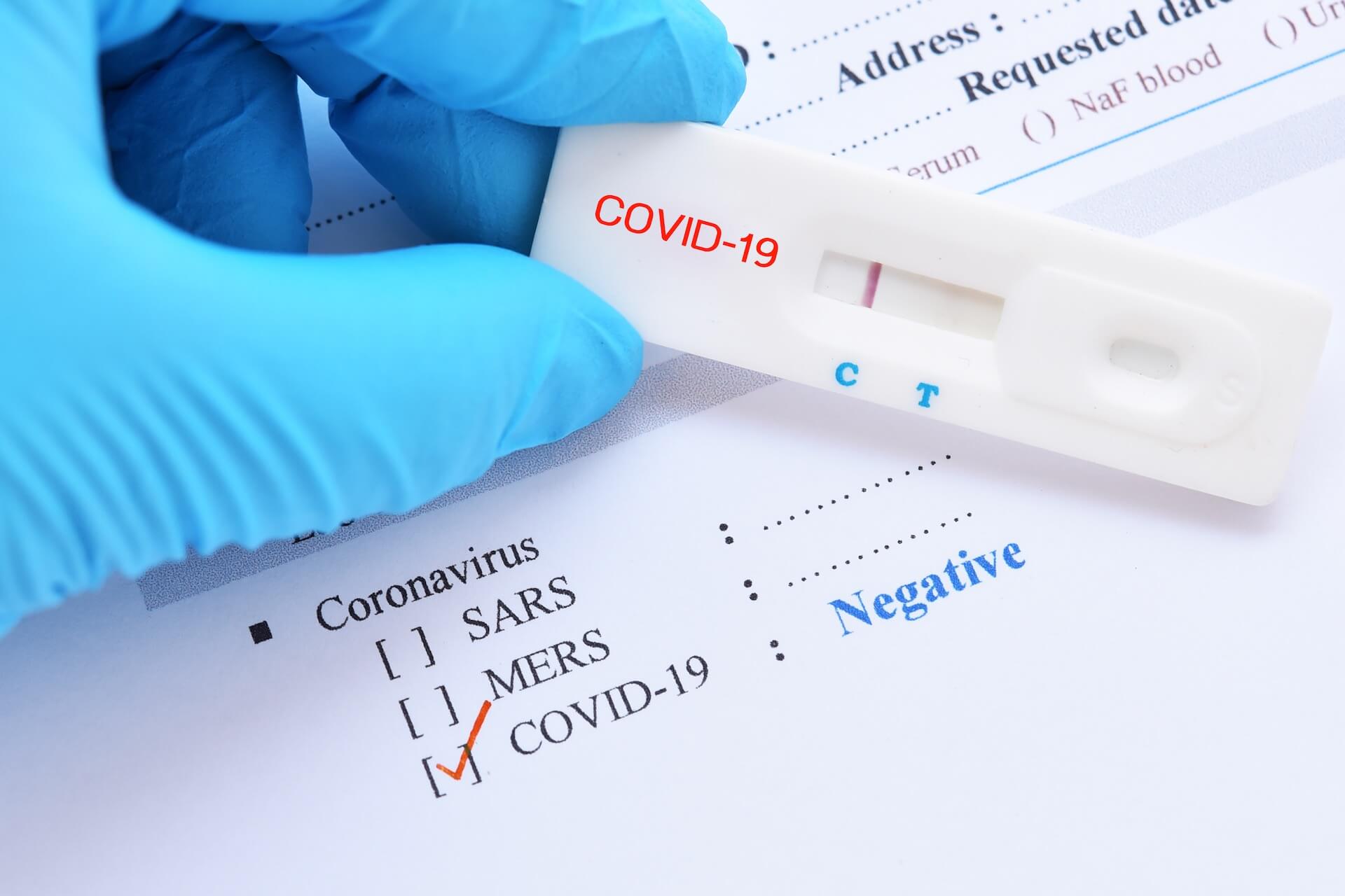 A Covid-19 test